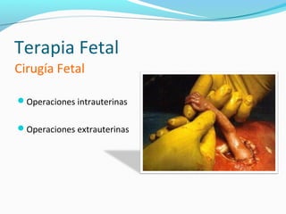 Terapia Fetal
Cirugía Fetal

Operaciones intrauterinas


Operaciones extrauterinas
 
