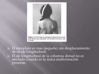    El omoplato es mas pequeño, sin desplazamiento
    de su eje longitudinal.
   El eje longitudinal de la columna dorsal no es
    afectado cuando es la única malformación
    presente.
 