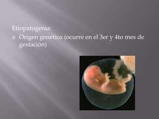 Etiopatogenia:
 Origen genético (ocurre en el 3er y 4to mes de
   gestación)
 