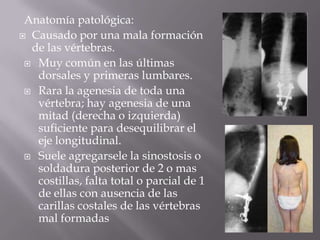 Anatomía patológica:
 Causado por una mala formación
  de las vértebras.
  Muy común en las últimas
   dorsales y primeras lumbares.
  Rara la agenesia de toda una
   vértebra; hay agenesia de una
   mitad (derecha o izquierda)
   suficiente para desequilibrar el
   eje longitudinal.
  Suele agregarsele la sinostosis o
   soldadura posterior de 2 o mas
   costillas, falta total o parcial de 1
   de ellas con ausencia de las
   carillas costales de las vértebras
   mal formadas
 