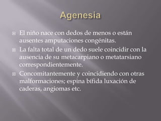    El niño nace con dedos de menos o están
    ausentes amputaciones congénitas.
   La falta total de un dedo suele coincidir con la
    ausencia de su metacarpiano o metatarsiano
    correspondientemente.
   Concomitantemente y coincidiendo con otras
    malformaciones; espina bífida luxación de
    caderas, angiomas etc.
 