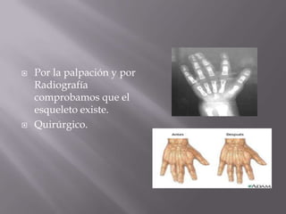    Por la palpación y por
    Radiografía
    comprobamos que el
    esqueleto existe.
   Quirúrgico.
 
