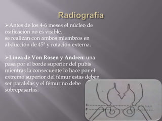 Antes de los 4-6 meses el núcleo de
osificación no es visible.
se realizan con ambos miembros en
abducción de 45ª y rotación externa.

Línea de Von Rosen y Andren: una
pasa por el borde superior del pubis
mientras la consecuente lo hace por el
extremo superior del fémur estas deben
ser paralelas y el fémur no debe
sobrepasarlas.
 