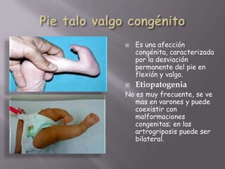    Es una afección
    congénita, caracterizada
    por la desviación
    permanente del pie en
    flexión y valgo.
   Etiopatogenia
No es muy frecuente, se ve
   mas en varones y puede
   coexistir con
   malformaciones
   congenitas; en las
   artrogriposis puede ser
   bilateral.
 
