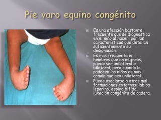   Es una afección bastante
    frecuente que se diagnostica
    en el niño al nacer, por las
    características que detallan
    suficientemente su
    designación.
   Es mas frecuente en
    hombres que en mujeres,
    puede ser unilateral o
    bilateral, pero cuando lo
    padecen las niñas es mas
    común que sea unilateral .
   Puede asociarse a otras mal
    formaciones externas: labios
    leporino, espina bífida,
    luxación congénita de cadera.
 