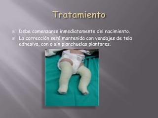    Debe comenzarse inmediatamente del nacimiento.
   La corrección será mantenida con vendajes de tela
    adhesiva, con o sin planchuelas plantares.
 