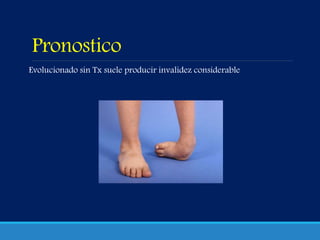 Pronostico
Evolucionado sin Tx suele producir invalidez considerable
 
