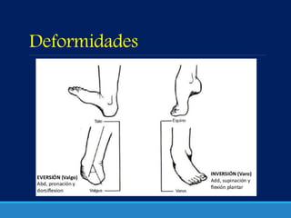 Deformidades
 