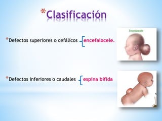 *Clasificación
*Defectos superiores o cefálicos encefalocele.
*Defectos inferiores o caudales espina bífida
 