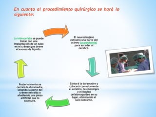En cuanto al procedimiento quirúrgico se hará lo
siguiente:
El neurocirujano
extraerá una parte del
cráneo (craneotomía)
para acceder al
cerebro.
Cortará la duramadre y
colocará correctamente
el cerebro, las meninges
y el líquido
cefalorraquídeo en su
lugar, eliminando el
saco sobrante.
Posteriormente se
cerrará la duramadre,
sellando la parte del
cráneo extraída o
añadiendo una pieza
artificial que lo
sustituya.
La hidrocefalia se puede
tratar con una
implantación de un tubo
en el cráneo que drene
el exceso de líquido.
 