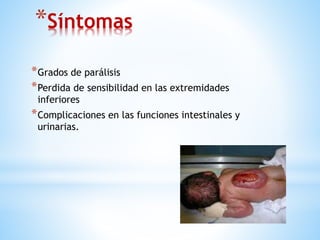 *Síntomas
*Grados de parálisis
*Perdida de sensibilidad en las extremidades
inferiores
*Complicaciones en las funciones intestinales y
urinarias.
 
