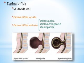 *
*Se divide en:
• Espina bífida oculta
• Espina bífida abierta
Mielosquisis,
Mielomeningocele
Meningocele
 