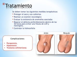*Tratamiento
Se deben tomar las siguientes medidas terapéuticas:
• Proteger el saco y sus cubiertas
• Realizar un examen neurológico
• Evaluar la existencia de anomalías asociadas
• Reparar el defecto preferiblemente dentro de las
36 horas para evitar una fistula de LCR y
meningitis.
• Controlar la hidrocefalia
Complicaciones:
• Paraparesia,
• Hipoestesia
• Trastonos esfinterianos
 