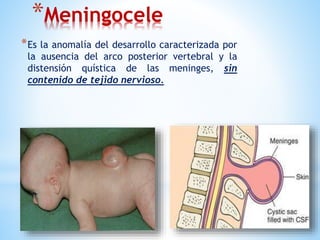 *Meningocele
*Es la anomalía del desarrollo caracterizada por
la ausencia del arco posterior vertebral y la
distensión quística de las meninges, sin
contenido de tejido nervioso.
 
