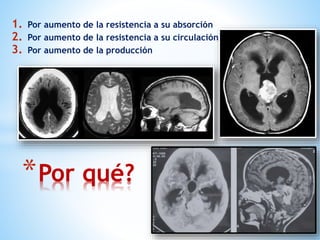 *Por qué?
1. Por aumento de la resistencia a su absorción
2. Por aumento de la resistencia a su circulación
3. Por aumento de la producción
 