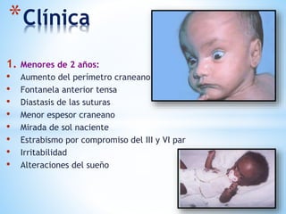 *Clínica
1. Menores de 2 años:
• Aumento del perímetro craneano
• Fontanela anterior tensa
• Diastasis de las suturas
• Menor espesor craneano
• Mirada de sol naciente
• Estrabismo por compromiso del III y VI par
• Irritabilidad
• Alteraciones del sueño
 