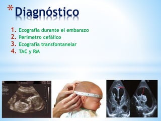 *Diagnóstico
1. Ecografía durante el embarazo
2. Perímetro cefálico
3. Ecografía transfontanelar
4. TAC y RM
 