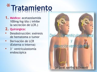 *Tratamiento
1. Médico: acetazolamida
100mg/kg/dia ( inhibe
la secreción de LCR.)
2. Quirúrgico:
• Desobstrucción: exéresis
de hematoma o tumor
• Derivación de LCR
(Externa o interna)
• 3° ventriculostomía
endoscópica
 