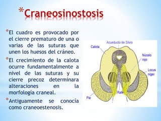 *Craneosinostosis
*El cuadro es provocado por
el cierre prematuro de una o
varias de las suturas que
unen los huesos del cráneo.
*El crecimiento de la calota
ocurre fundamentalmente a
nivel de las suturas y su
cierre precoz determinara
alteraciones en la
morfología craneal.
*Antiguamente se conocía
como craneoestenosis.
 