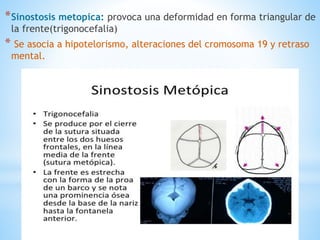 *Sinostosis metopica: provoca una deformidad en forma triangular de
la frente(trigonocefalia)
* Se asocia a hipotelorismo, alteraciones del cromosoma 19 y retraso
mental.
 