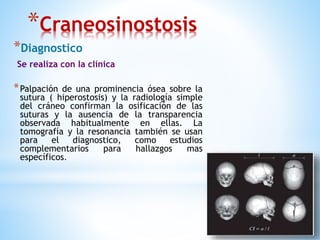 *Craneosinostosis
*Diagnostico
Se realiza con la clínica
*Palpación de una prominencia ósea sobre la
sutura ( hiperostosis) y la radiología simple
del cráneo confirman la osificación de las
suturas y la ausencia de la transparencia
observada habitualmente en ellas. La
tomografía y la resonancia también se usan
para el diagnostico, como estudios
complementarios para hallazgos mas
específicos.
 