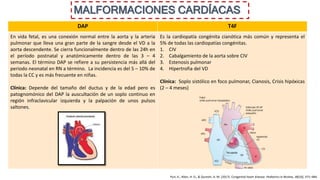 MALFORMACIONES CARDÍACAS
DAP T4F
En vida fetal, es una conexión normal entre la aorta y la arteria
pulmonar que lleva una gran parte de la sangre desde el VD a la
aorta descendente. Se cierra funcionalmente dentro de las 24h en
el período postnatal y anatómicamente dentro de las 3 – 4
semanas. El término DAP se refiere a su persistencia más allá del
periodo neonatal en RN a término. La incidencia es del 5 – 10% de
todas la CC y es más frecuente en niñas.
Clínica: Depende del tamaño del ductus y de la edad pero es
patognomónico del DAP la auscultación de un soplo continuo en
región infraclavicular izquierda y la palpación de unos pulsos
saltones.
Es la cardiopatía congénita cianótica más común y representa el
5% de todas las cardiopatías congénitas.
1. CIV
2. Cabalgamiento de la aorta sobre CIV
3. Estenosis pulmonar
4. Hipertrofia del VD
Clínica: Soplo sistólico en foco pulmonar, Cianosis, Crisis hipóxicas
(2 – 4 meses)
Puri, K., Allen, H. D., & Qureshi, A. M. (2017). Congenital heart disease. Pediatrics in Review, 38(10), 471–484.
 