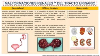 MALFORMACIONES RENALES Y DEL TRACTO URINARIO
Agenesia Renal Riñón en Herradura Quistes renales
Ausencia de uno o ambos riñones. El recién
nacido presenta habitualmente síndrome de
Potter, sin embargo otras patologías también
pueden causar este cuadro.
En algunos casos de agenesia renal bilateral
se ha observado antecedentes familiares en
1°, lo cual implica un riesgo de recurrencia
alto para futura descendencia. La diabetes
materna pregestacional también puede ser
causa de agenesia renal.
Es la anomalía de fusión más frecuente,
ocurriendo (0,4-1,6/10.000 RNV). 1/3 a 1/2
tienen anomalías congénitas urológicas y
genitales acompañantes (RVU –
Hidronefrosis), así como alteraciones
genéticas.
Una gran parte de los pacientes tienen un
buen pronóstico; sin embargo, estos niños
parecen tener un riesgo incrementado de
desarrollar tumor de Wilms. La mayoría son
asintomáticos, aunque la hidronefrosis
ocurre en un 80% de los casos.
 Quiste renal simple
 Poliquistosis renal autosómica
 Poliquistosis renal recesiva
 Displasia renal multiquística
Gutierrez Segura, A; Gomez Farpon, A. (2014). Anomalías congénitas del útero. Progresos de Obstetricia y Ginecología, 57(4), 191–200.
 