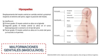 MALFORMACIONES
GENITALES (MASCULINOS)
Desplazamiento del meato uretral en sentido ventral y proximal
respecto al extremo del pene; según la posición del meato.
Se clasifica en:
 Primer grado: El meato uretral se ubica en el glande
 Segundo grado: El meato uretral se ubica en el surco
balanoprepucial o coronal o en el eje del pene
 Tercer grado: El meato uretral se ubica en la unión del pene
y el escroto o el perineo
Hipospadias
OMS/CDC/ICBDSR. (2015). Vigilancia de anomalías congénitas: Atlas de Algunos Defectos Congénitos.
 