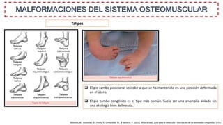 MALFORMACIONES DEL SISTEMA OSTEOMUSCULAR
Talipes
 El pie zambo posicional se debe a que se ha mantenido en una posición deformada
en el útero.
 El pie zambo congénito es el tipo más común. Suele ser una anomalía aislada sin
una etiología bien delineada.
Bidondo, M., Groisman, B., Flores, R., Ormazabal, M., & Barbero, P. (2015). Atlas RENAC. Guía para la detección y descripción de las anomalías congénitas. 1–53.
 