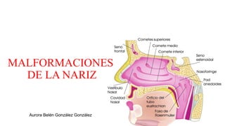 MALFORMACIONES
DE LA NARIZ
Aurora Belén González González
 