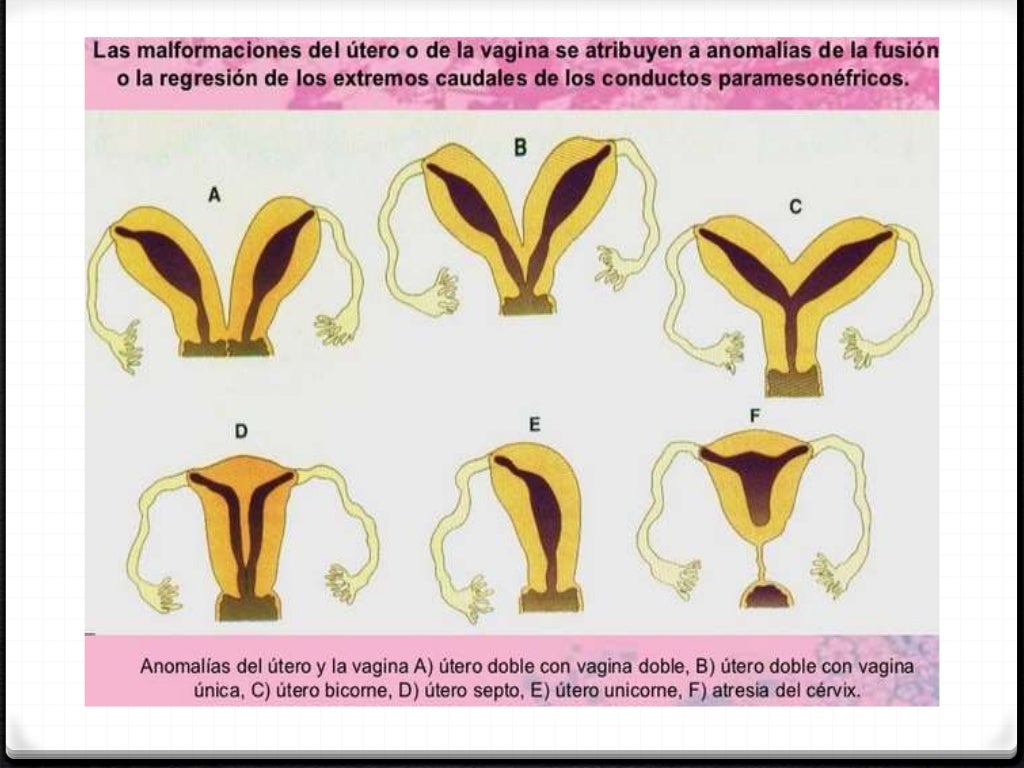 Malformaciones del aparato genital femenino