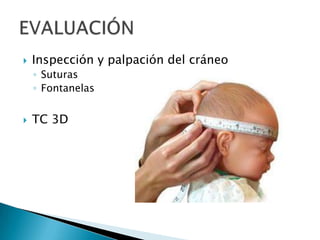  Inspección y palpación del cráneo
◦ Suturas
◦ Fontanelas
 TC 3D
 