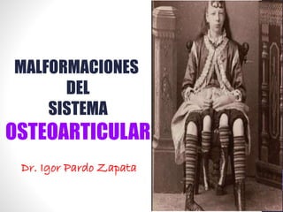 MALFORMACIONES
DEL
SISTEMA
OSTEOARTICULAR
Dr. Igor Pardo Zapata
 