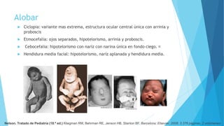 Alobar
 Ciclopia: variante mas extrema, estructura ocular central única con arrinia y
proboscis
 Etmocefalia: ojos separados, hipotelorismo, arrinia y proboscis.
 Cebocefalia: hipotelorismo con naríz con narina única en fondo ciego.
 Hendidura media facial: hipotelorismo, naríz aplanada y hendidura media.
Nelson. Tratado de Pediatría (18.ª ed.) Kliegman RM, Behrman RE, Jenson HB, Stanton BF. Barcelona: Elsevier, 2008. 3.376 páginas. 2 volúmenes
 