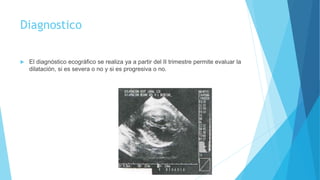 Diagnostico
 El diagnóstico ecográfico se realiza ya a partir del II trimestre permite evaluar la
dilatación, si es severa o no y si es progresiva o no.
 