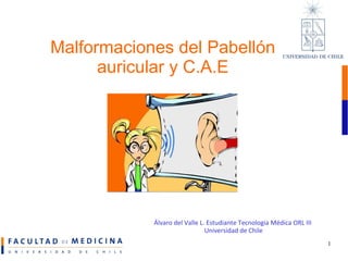 Malformaciones del Pabellón auricular y C.A.E Álvaro del Valle L. Estudiante Tecnología Médica ORL III  Universidad de Chile 