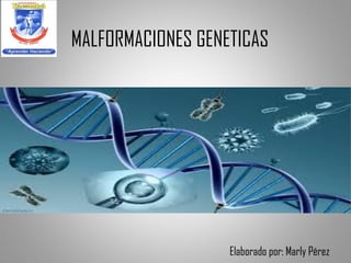 MALFORMACIONES GENETICAS
Elaborado por: Marly Pérez
 