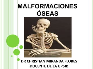 MALFORMACIONES
ÓSEAS
DR CHRISTIAN MIRANDA FLORES
DOCENTE DE LA UPSJB
 