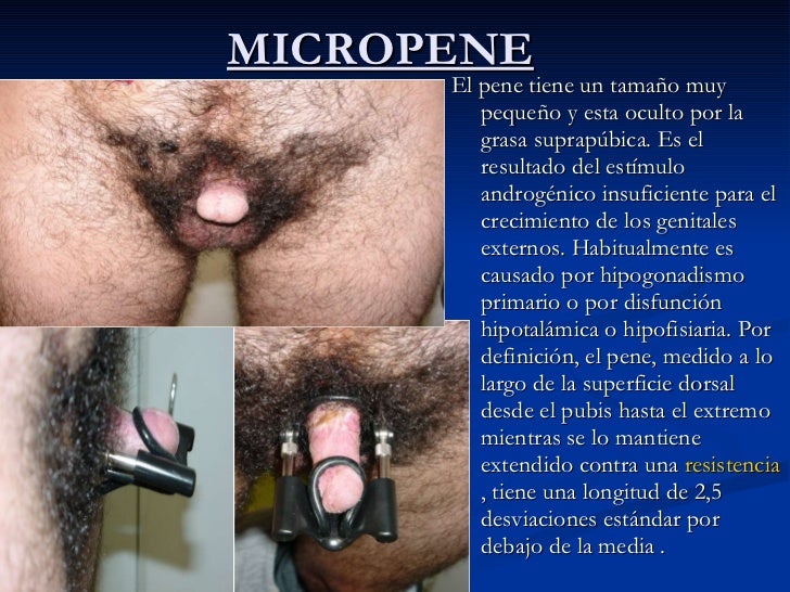 Para el aumento del miembro por la anchura