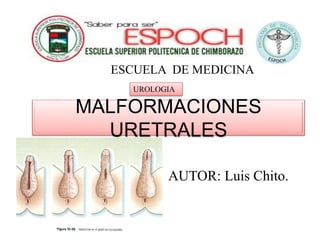 MALFORMACIONES
URETRALES
AUTOR: Luis Chito.
ESCUELA DE MEDICINA
UROLOGIA
 