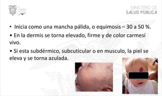 • Inicia como una mancha pálida, o equimosis – 30 a 50 %.
• En la dermis se torna elevado, firme y de color carmesí
vivo.
• Si esta subdérmico, subcuticular o en musculo, la piel se
eleva y se torna azulada.
11
 