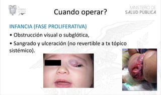 Cuando operar?
INFANCIA (FASE PROLIFERATIVA)
• Obstrucción visual o subglótica,
• Sangrado y ulceración (no revertible a tx tópico
sistémico).
31
 