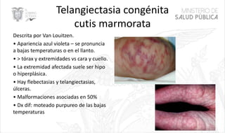 Telangiectasia congénita
cutis marmorata
Descrita por Van Louitzen.
• Apariencia azul violeta – se pronuncia
a bajas temperaturas o en el llanto.
• > tórax y extremidades vs cara y cuello.
• La extremidad afectada suele ser hipo
o hiperplásica.
• Hay flebectasias y telangiectasias,
úlceras.
• Malformaciones asociadas en 50%
• Dx dif: moteado purpureo de las bajas
temperaturas
42
 