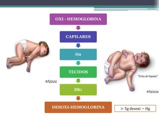 OXI - HEMOGLOBINA
CAPILARES
O2
TECIDOS
Hb↓
DESOXI-HEMOGLOBINA > 5g desoxi − Hg
 