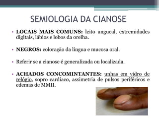 SEMIOLOGIA DA CIANOSE
• LOCAIS MAIS COMUNS: leito ungueal, extremidades
digitais, lábios e lobos da orelha.
• NEGROS: coloração da língua e mucosa oral.
• Referir se a cianose é generalizada ou localizada.
• ACHADOS CONCOMINTANTES: unhas em vidro de
relógio, sopro cardíaco, assimetria de pulsos periféricos e
edemas de MMII.
 