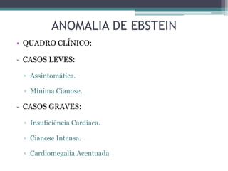 • QUADRO CLÍNICO:
- CASOS LEVES:
▫ Assintomática.
▫ Mínima Cianose.
- CASOS GRAVES:
▫ Insuficiência Cardíaca.
▫ Cianose Intensa.
▫ Cardiomegalia Acentuada
ANOMALIA DE EBSTEIN
 
