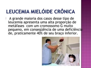 

 A grande maioria dos casos desse tipo de
leucemia apresenta uma alta proporção de
metáfases com um cromossomo G muito
pequeno, em conseqüência de uma deficiência
de, praticamente 40% de seu braço inferior.

 