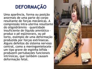 Uma aparência, forma ou posição
anormais de uma parte do corpo
resultante de forças mecânicas. A
compressão intra-uterina resultante
do oligoidrâmnio – quantidade
insuficiente de líquido amniótico –
produz o pé eqüinovaro, ou pé
torto, exemplo de uma deformação
produzida por forças extrínsecas.
Alguns defeitos do sistema nervoso
central, como a meningomielocele –
um tipo grave de espinha bifida –
produzem pertubações funcionais
intrínsicas, que também causam
deformação fetal.

 