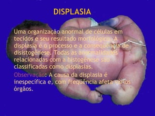 Uma organização anormal de células em
tecidos e seu resultado morfológico. A
displasia é o processo e a conseqüência de
disistogênese. Todas as anormalidades
relacionadas com a histogênese são
classificadas como displasias.
Observação: A causa da displasia é
inespecífica e, com freqüência afeta vários
órgãos.

 