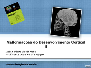 Malformações do Desenvolvimento Cortical
II
Acd. Norberto Weber Werle
Profº Carlos Jesus Pereira Haygert
www.radiologiaufsm.com.br
 